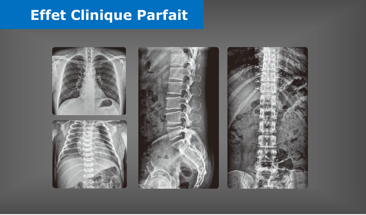 法语Mobile-Digital-Radiography-System-5.jpg